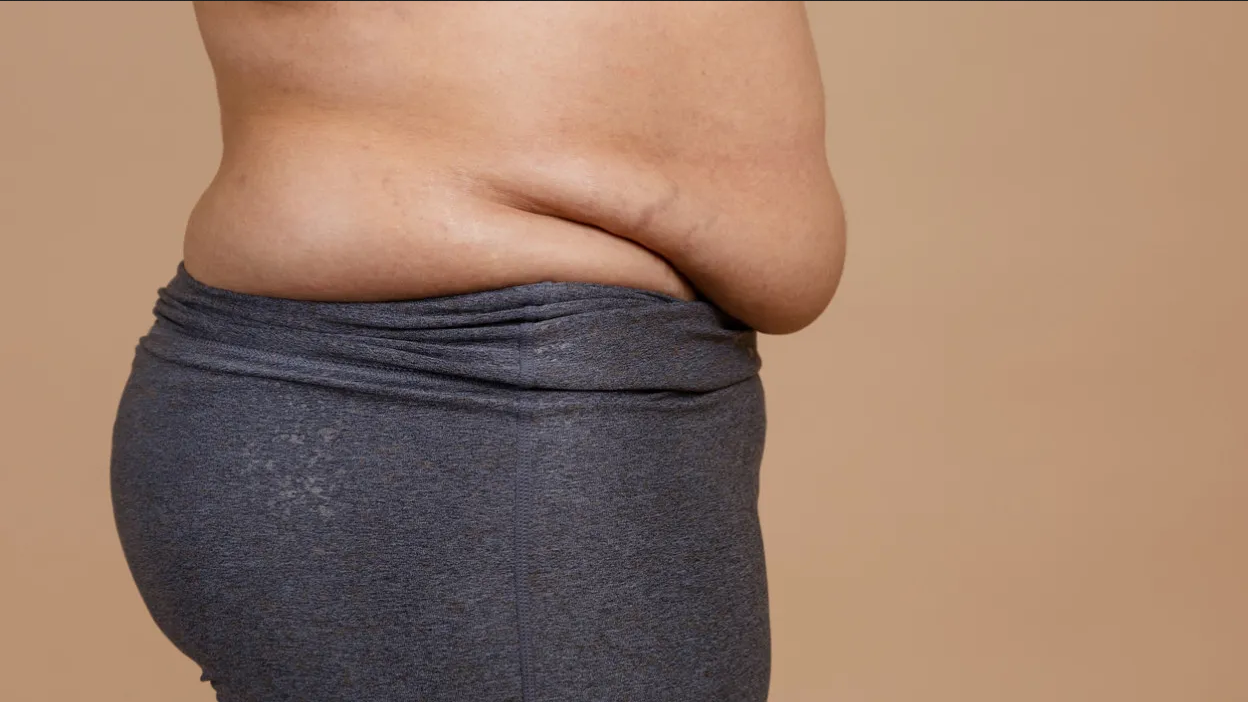 ¿Cómo combatir la flacidez del cuerpo? Incluye esta vitamina en tu alimentación