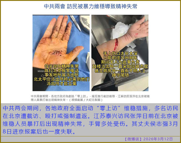 https://i.postimg.cc/8CSgN25j/20260312-bt-(5).jpg