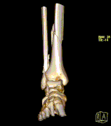 18 12 25 gleženj d vrt range 3 edit