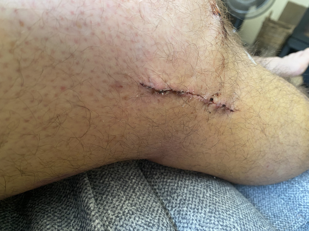 FD0113DA-1370-4503-AA79-D65B7D4E884B