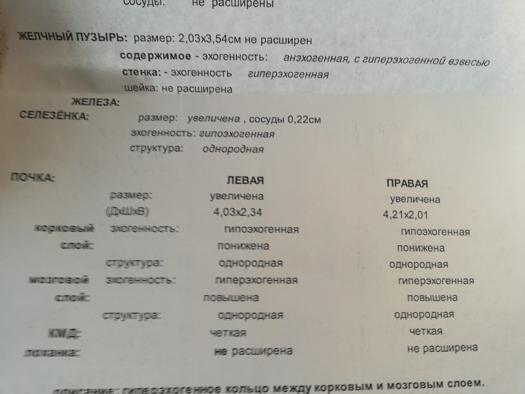 узи1 — Postimages