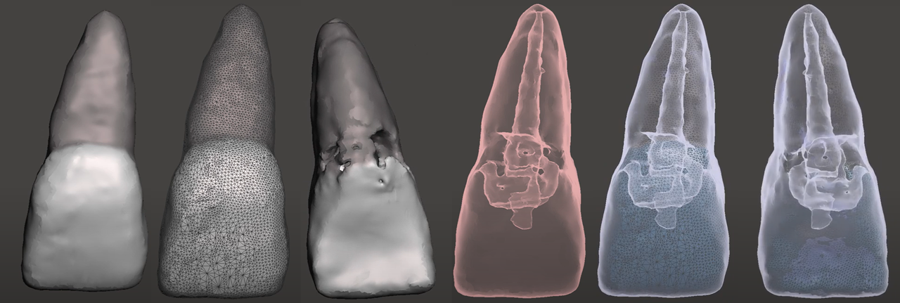Diagnóstico CBCT e IA