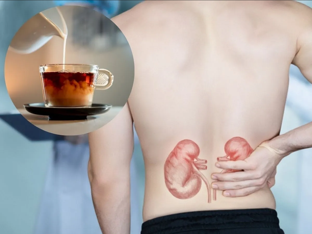 El lado oscuro del café: su impacto en la salud renal