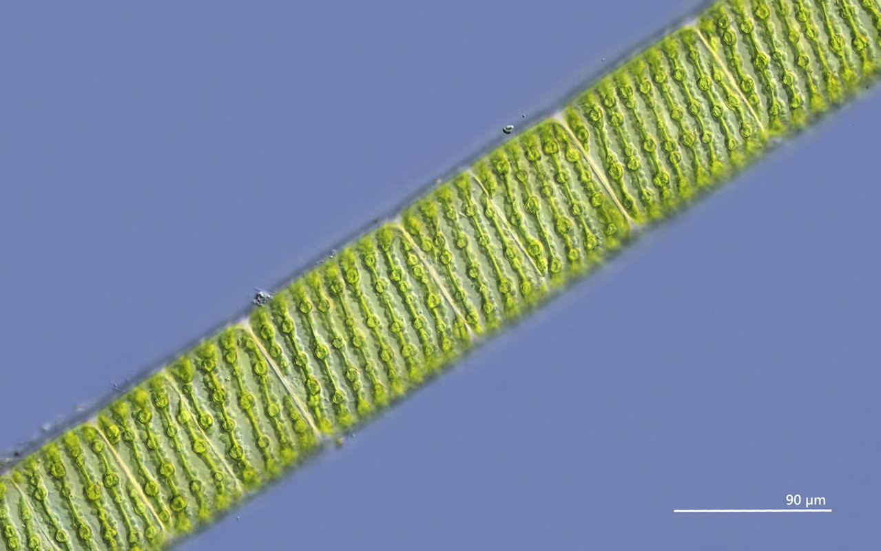 Spirogyra 20 (ev) longata Schraubenalge DIK 40 Stack 5