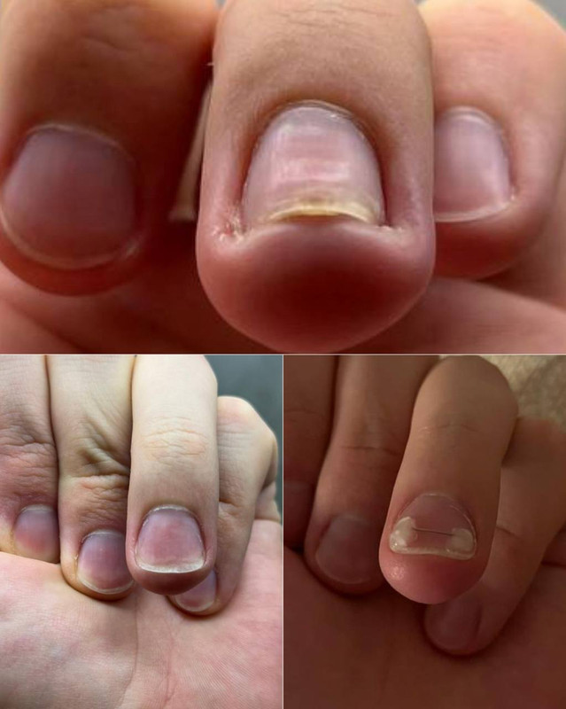 подология 4