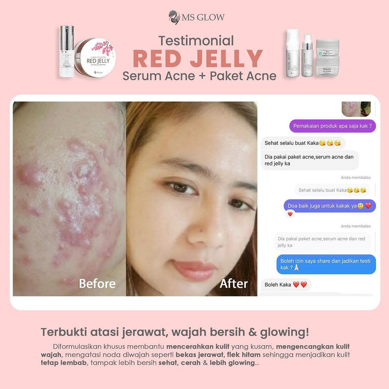 testimoni ms glow skin care
