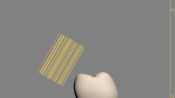 collision