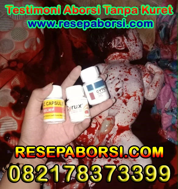 Testimoni Obat Aborsi 7 Bulan