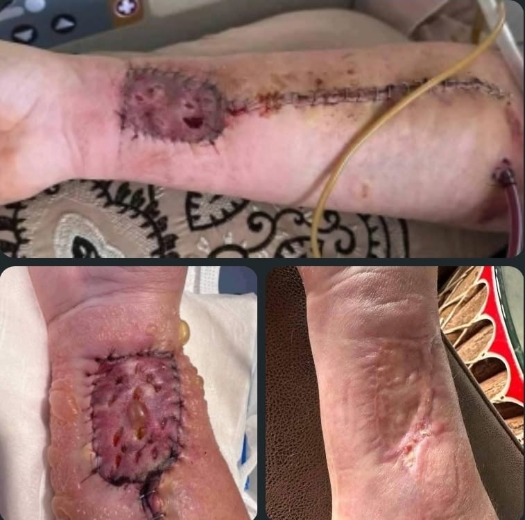 John M. before and after