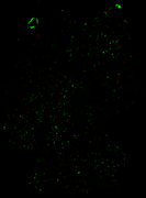 202607-diff-vf-4g