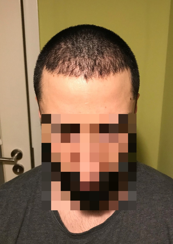 135 giorni 4 mesi e mezzo (2)