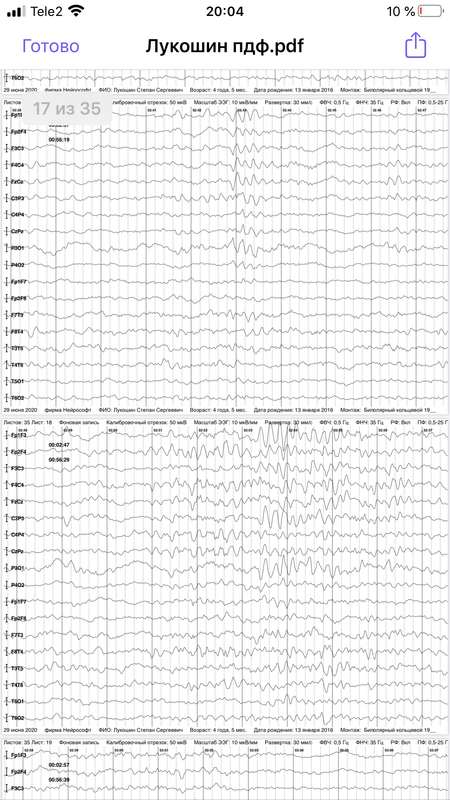 B4DF4E87-9FD6-4C62-8D79-50047976552A