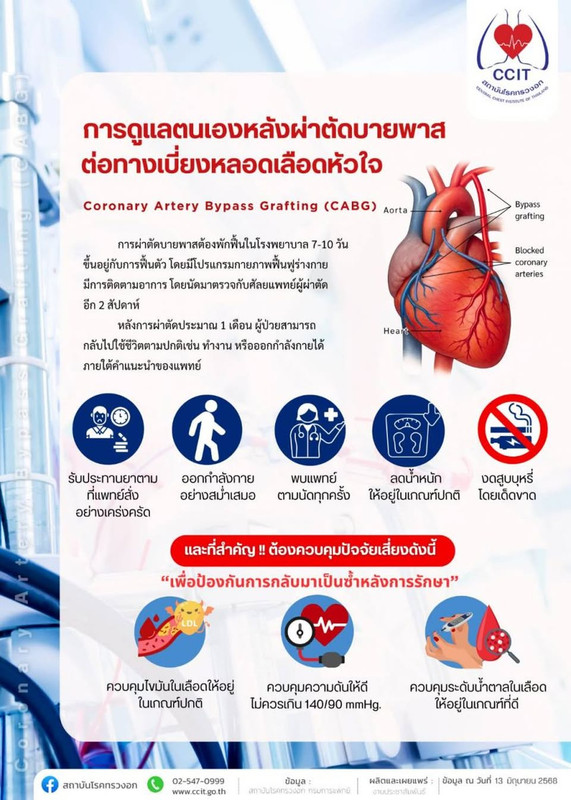 Coronary Artery Bypass Grafting