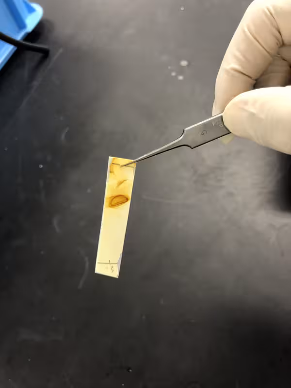 Organic Chemistry Lab Osaka TLC (Image 13)