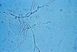 Gynecology question 4 image