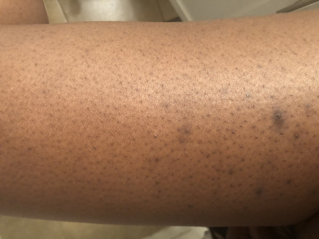 B32CE205-728B-423D-A64A-FFF12EA0F591