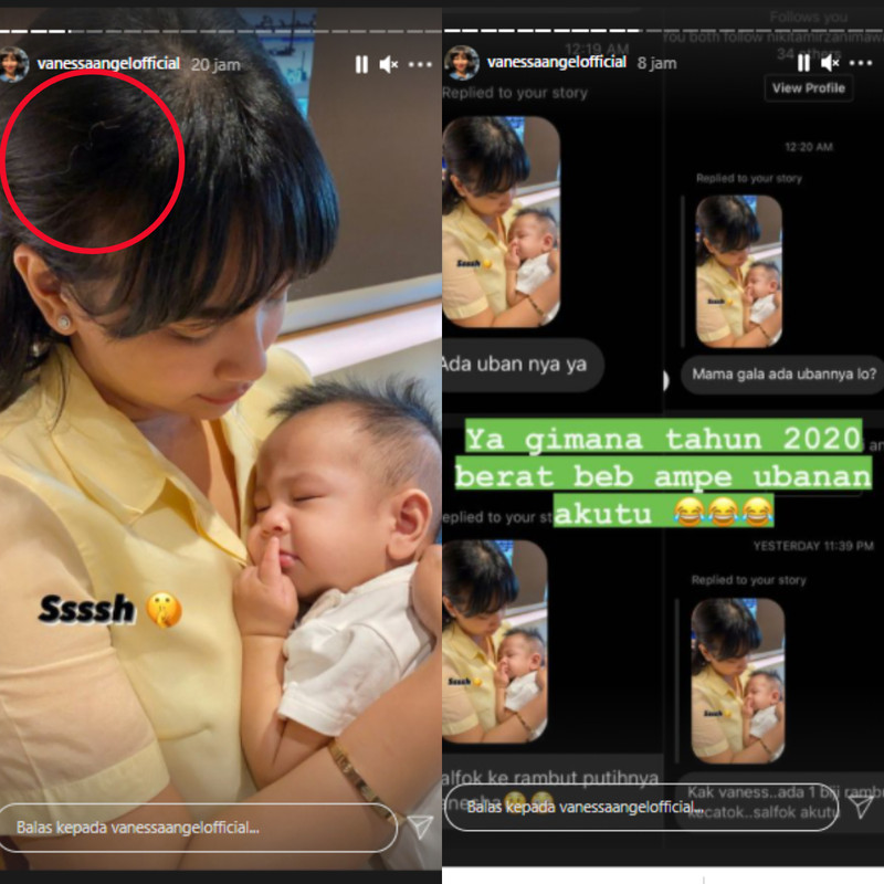 Vanessa Angel ubanan