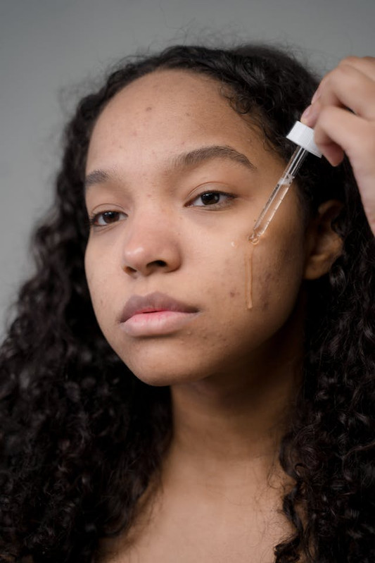 Woman with dark spots and uneven skin tone applying vitamin C serum to brighten skin and reduce pigmentation.