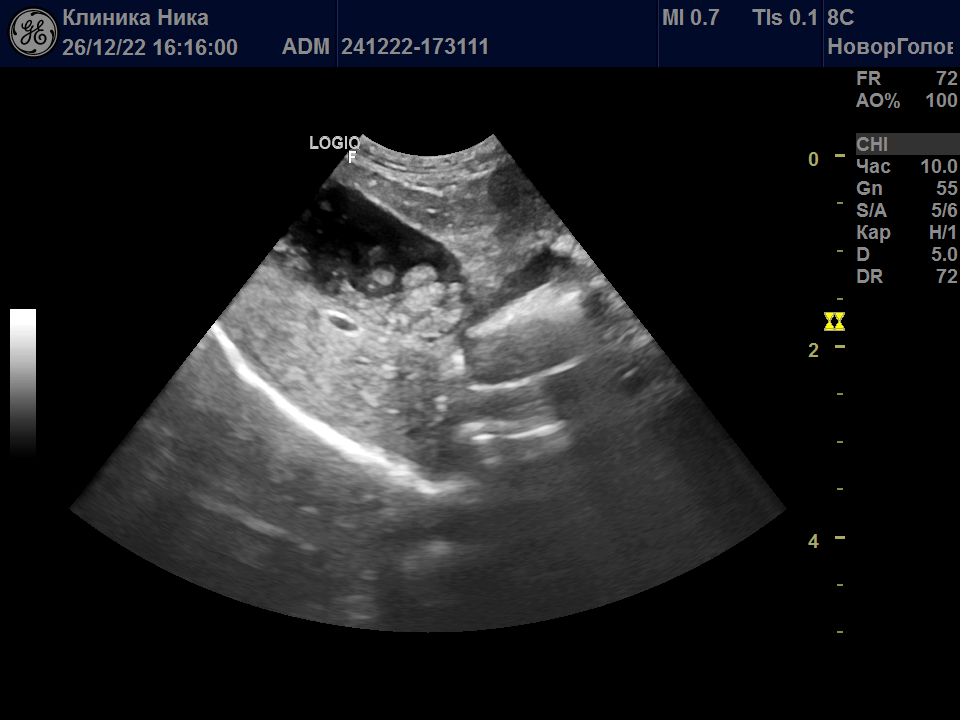 1672141919537_Image12