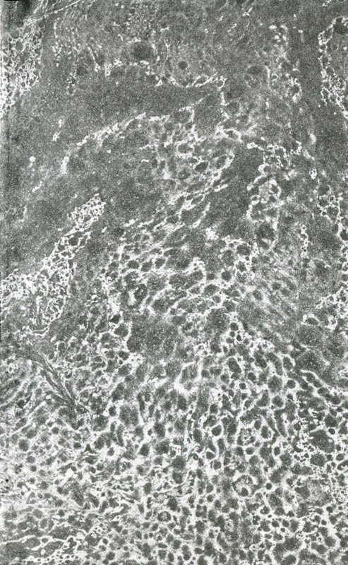 p0003