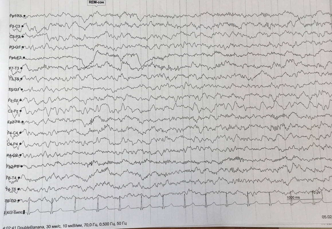 AEE9E9CE-9886-4693-9A13-638A37F7181E