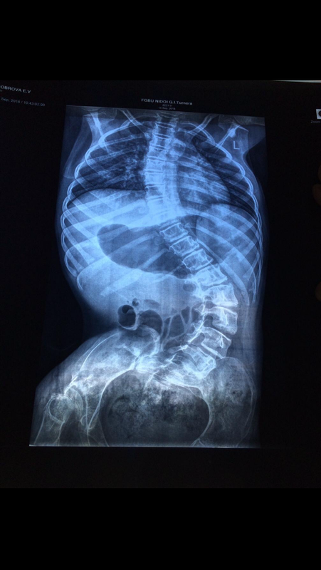 04B5FD3E-BBCC-4F04-9B15-7BA526EEFB9C