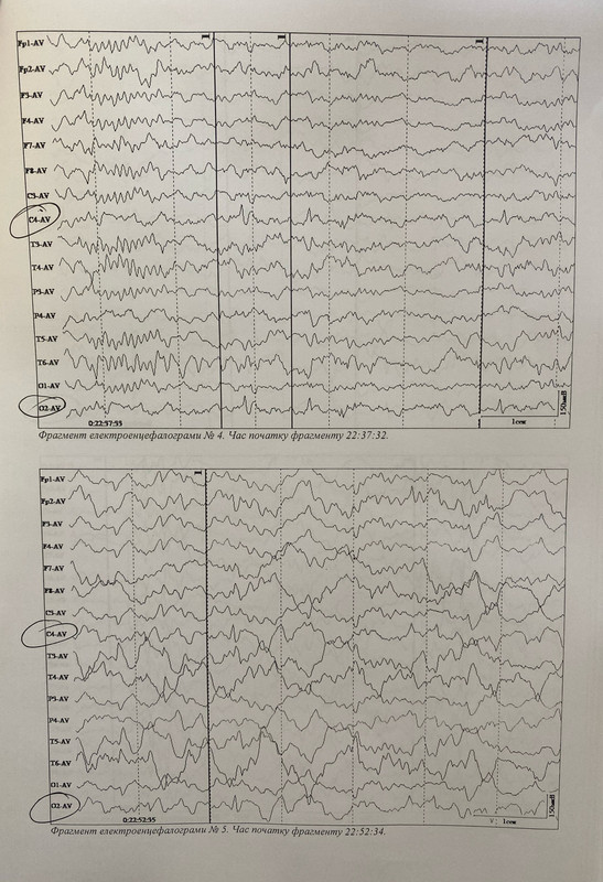 1AF79A3A-3100-47CE-A157-98176F4F8261