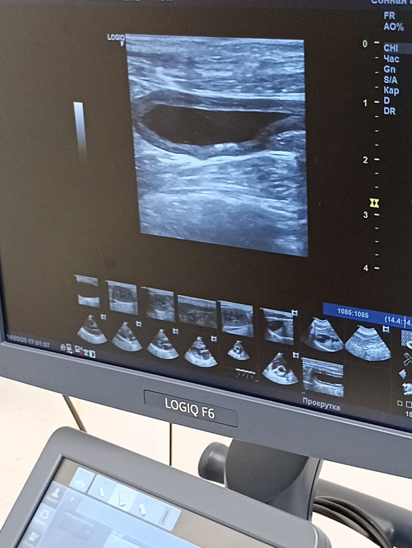 марс фото 4 сбор