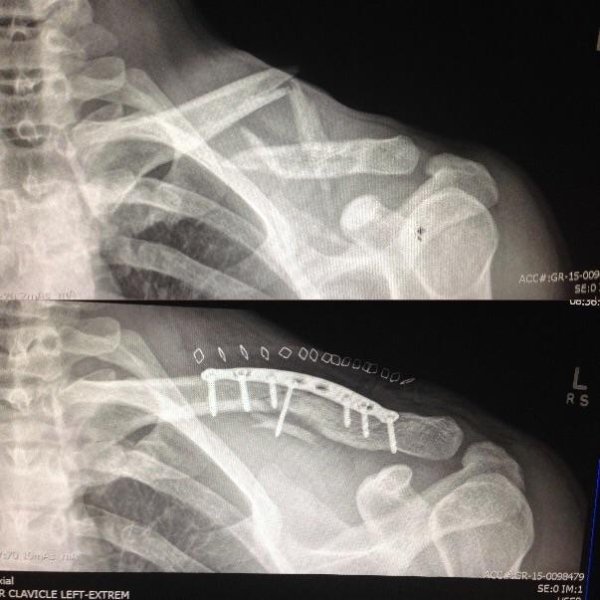 Before-after-7