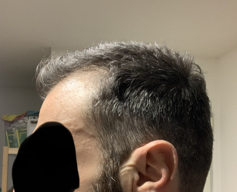 CFF8123D-4157-4B3F-80CC-73B3EEC26FA1_1_201_a