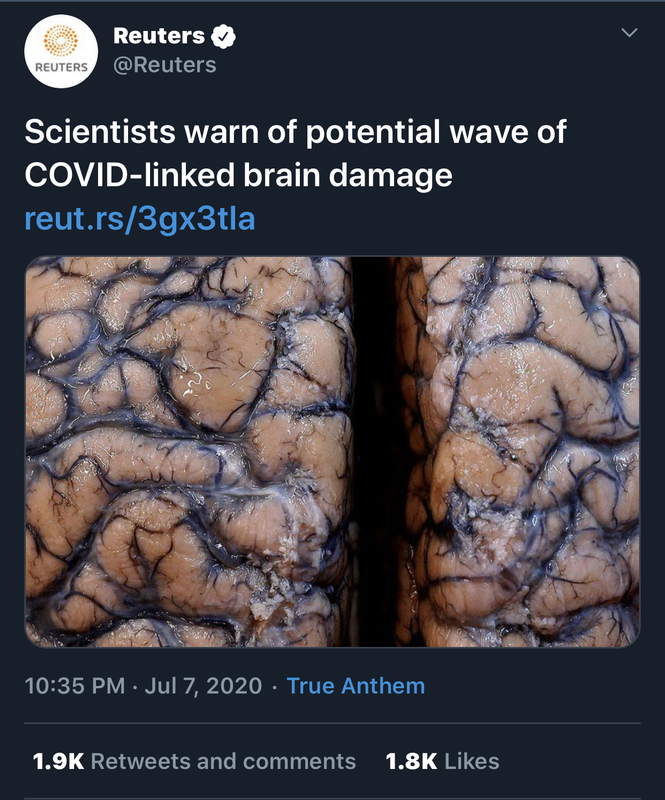 D32-A9-EBA-A9-EA-4817-9-D68-07182427-BC9