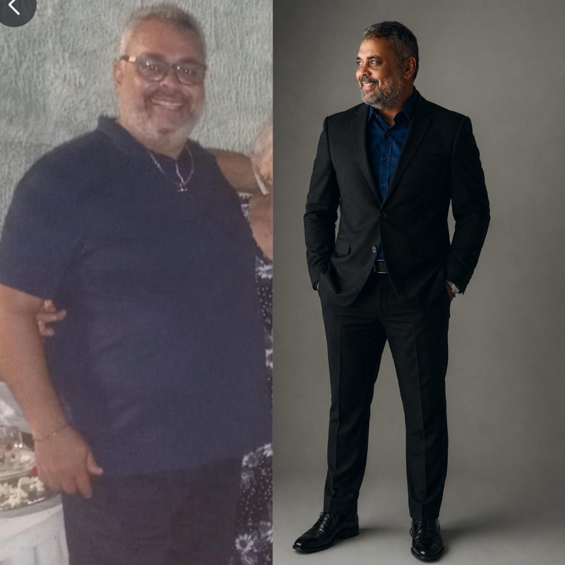 Resultado — antes e depois
