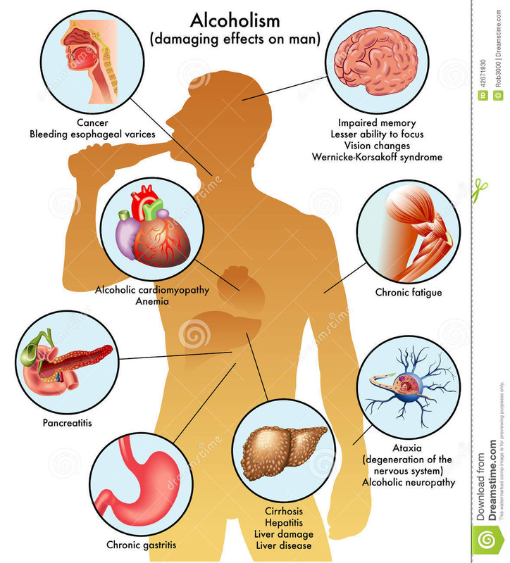 male-alcoholism-medical-illustration-damage-caused-alcohol-man-42671830.jpg