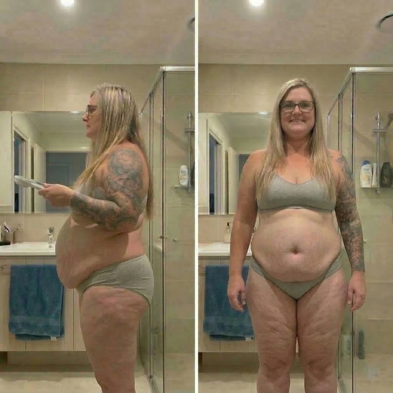 Before transformation