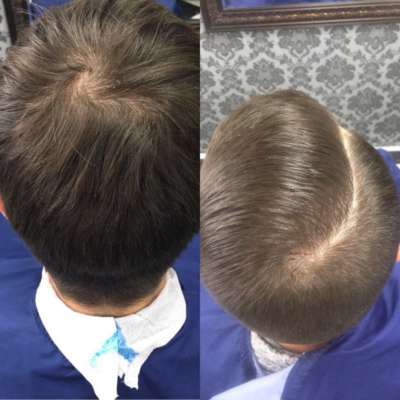 88479D1D-6B5F-4215-A5D3-3846380BAED6