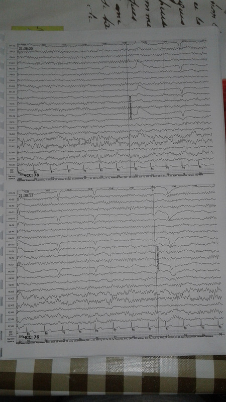 15105208527881841940134