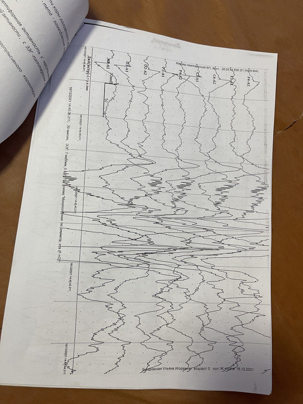 4DC6D41A-EE11-4D35-9A77-5E529EF3A974