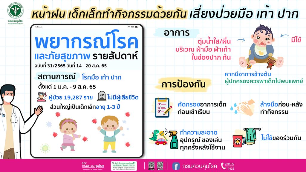 เตือนผู้ปกครองสังเกตอาการบุตรหลาน หากมีไข้ มีผื่นตามฝ่ามือฝ่าเท้า เสี่ยงป่วยโรคมือเท้าปาก
