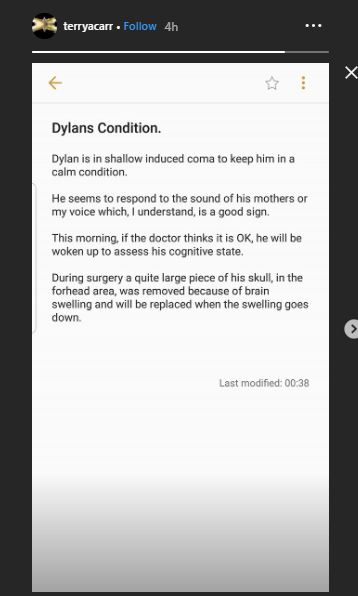 Ayah Dylan Carr bagikan kondisi terkini anaknya setelah jalani operasi pembengkakan otak 