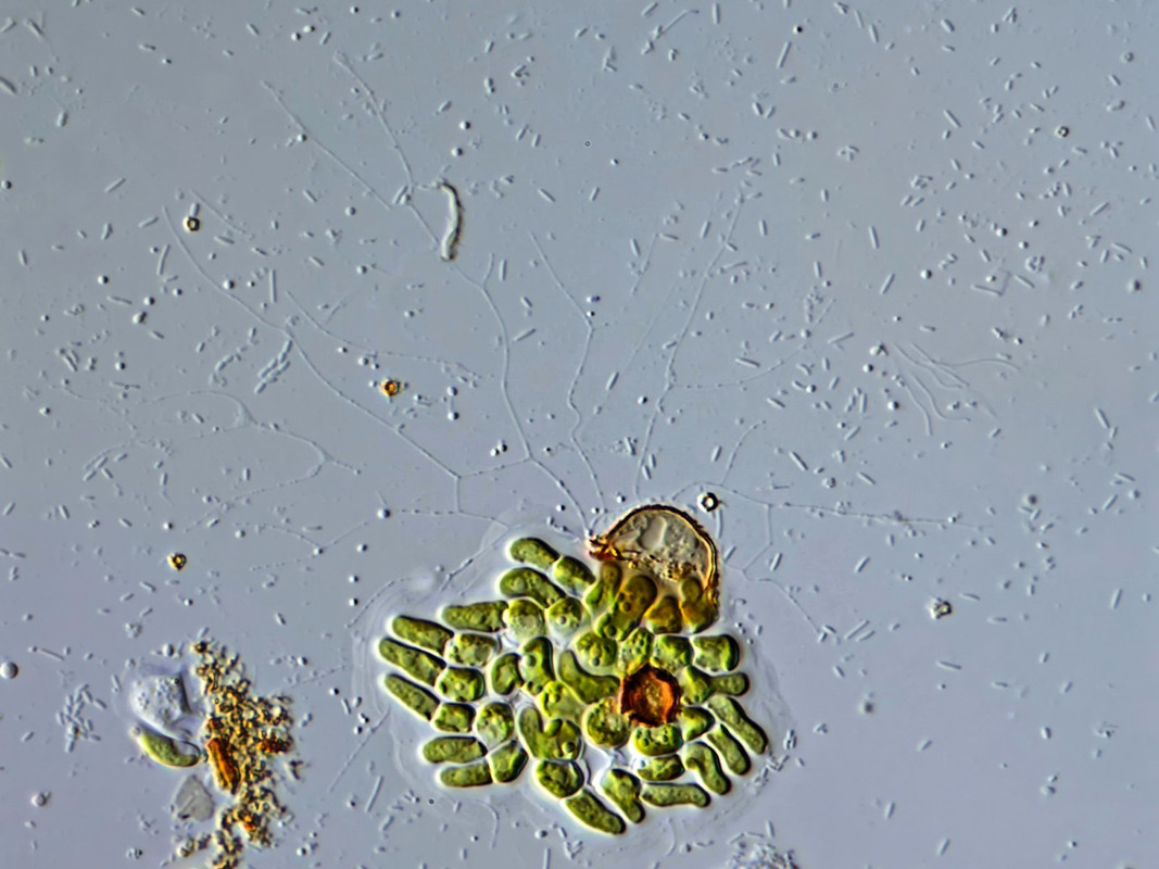 Microgromia 08 sp Filose Amöbe Seitenansicht auf Coleochaete (ev) soluta DIK 100 Stack 3