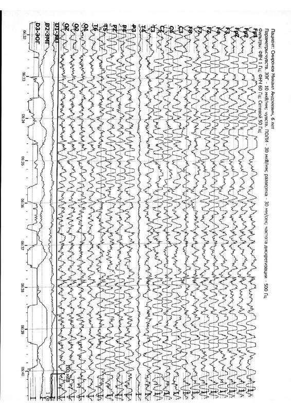 963873294b80479d965a30243f1151787COgqKfaoS7IG2sk-1