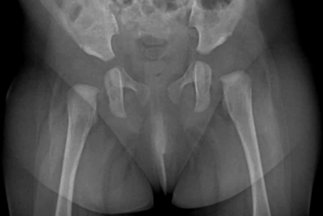 Безымянный