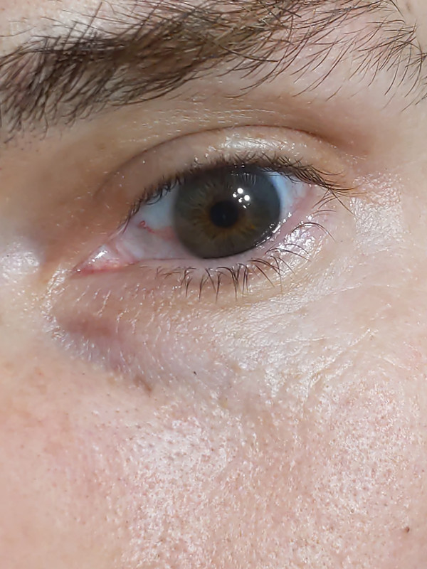 eye1