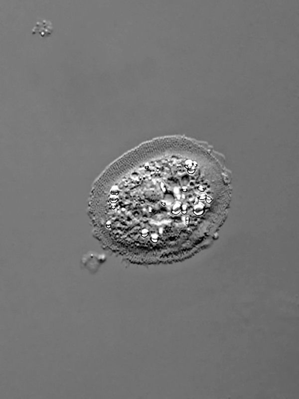 Cochliopodium 02 bilimbosum Schnecken-Amöbe DIK 50-Z7