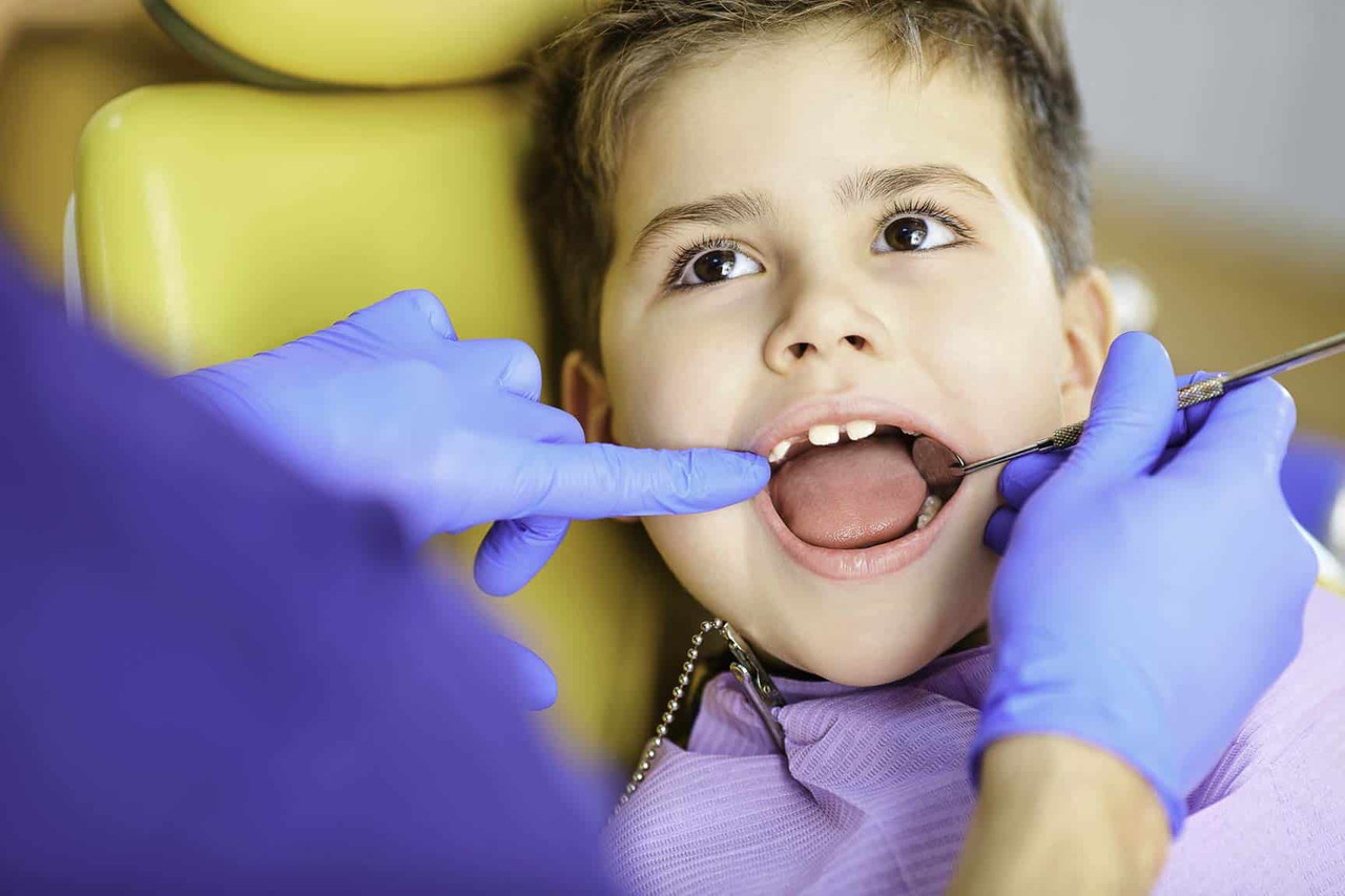 Baby Root Canal Procedure