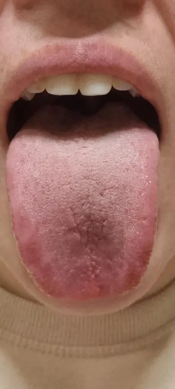 6-years-searching-for-diagnosis-just-found-multiple-v0-p6ceopyowyod1