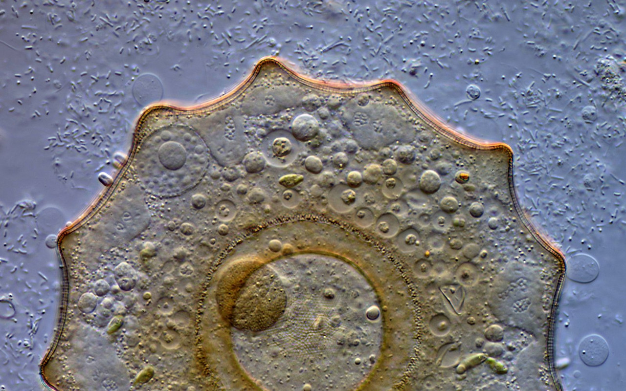 Arcella 20 dentata Gezähntes Uhrglastier Makronukleus DIK 100-Z7