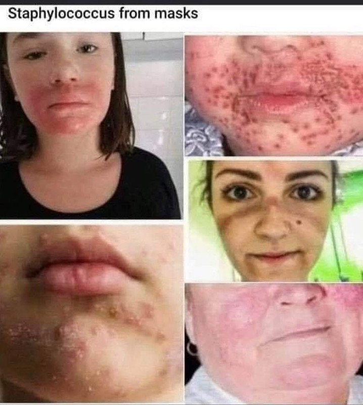 Mask-Mouth