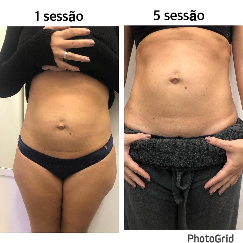 Projeto 3