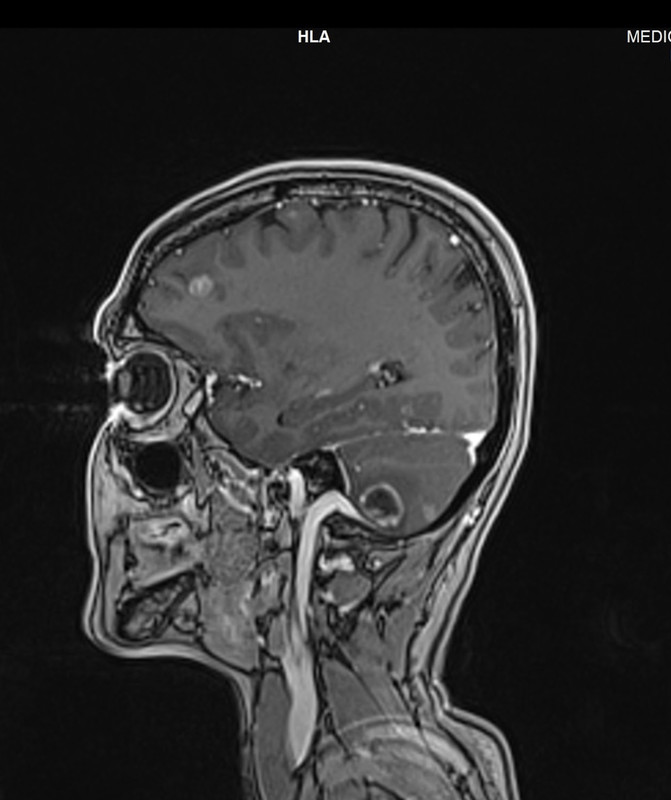 AA0AE70D-ADFE-4284-959F-8D6F163142AF